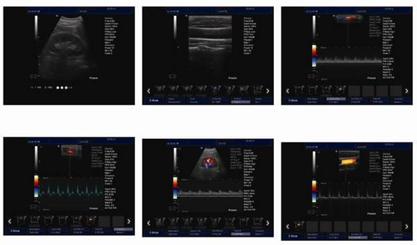 5200 Full Digital Color Doppler Ultrasound System