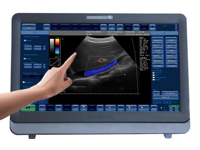 Touch Screen Doppler Ultrasound Scanner